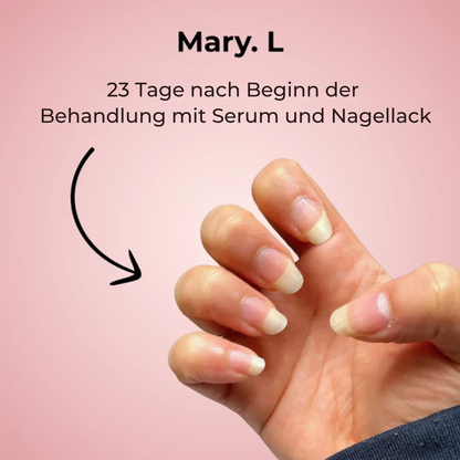 Nail Growth Serum | Nuvanta®